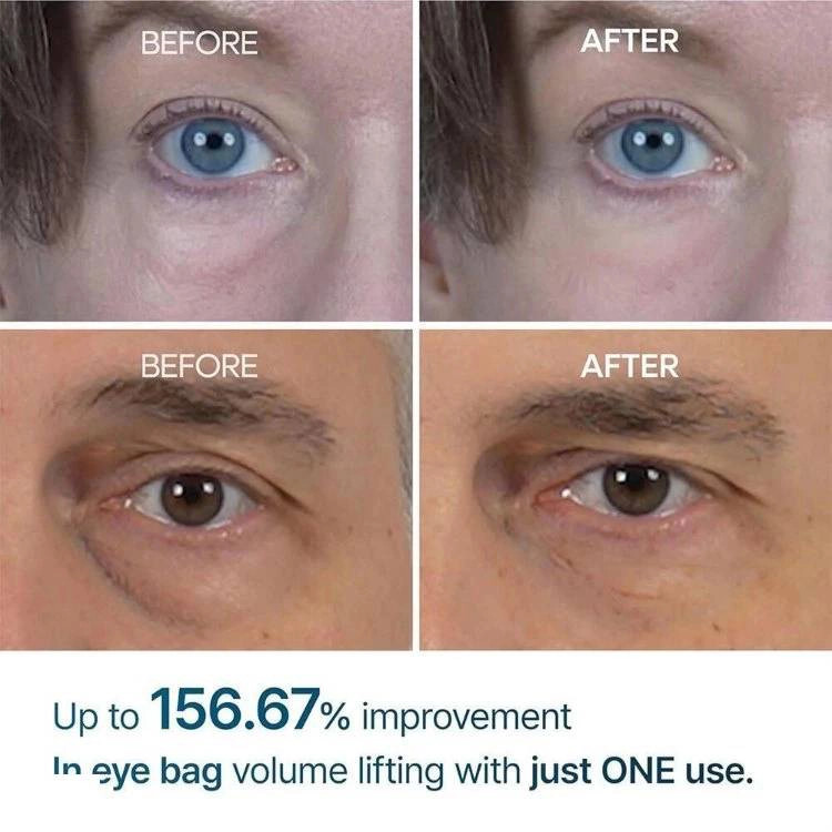 کرم دور چشم دکتر ملاکسین اصل Dr.Melaxin مدل Eyephalt از بین برنده ی کیسه زیر چشمی, تیرگی و پف وزن 10 گرم