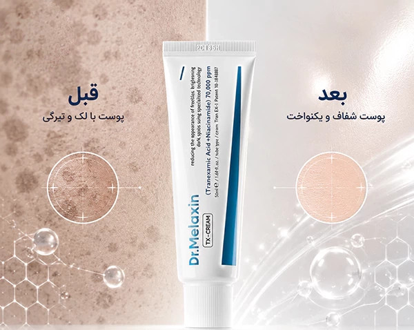 کرم ضد لک روشن کننده ترانگزامیک اسید دکتر ملاکسین اصل Dr.Melaxin حجم 50 میل