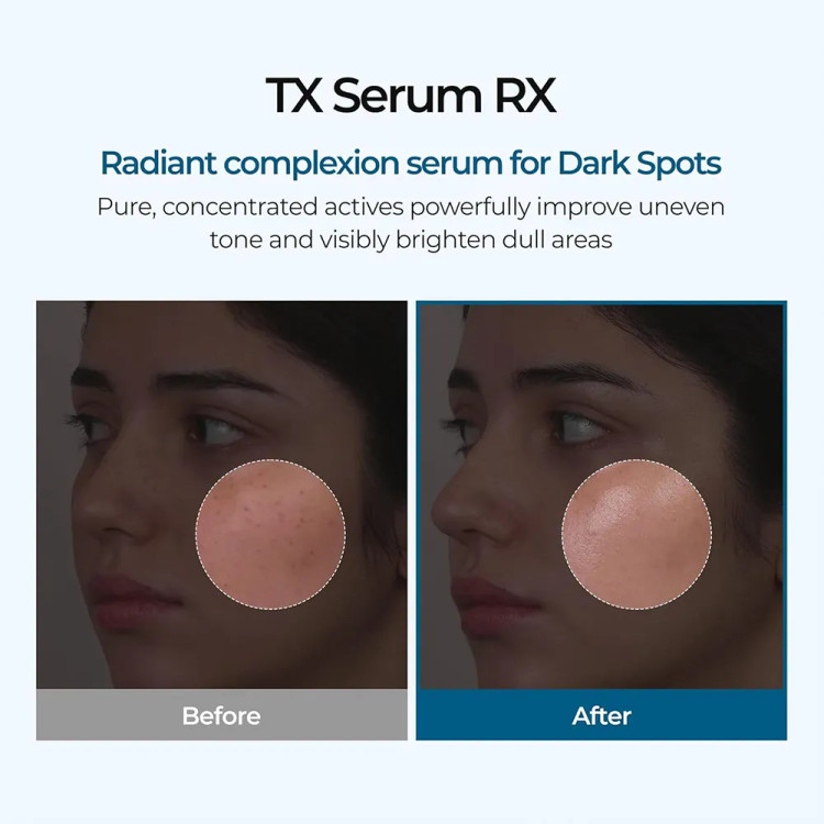 سرم ترانگزامیک اسید نیاسینامید دکتر ملاکسین اصل Dr. Melaxin TX Ampoule ضدلک و روشنکننده حجم 30 میل