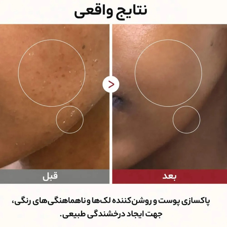 تونر ضد لک و مرطوب کننده دکتر ملاکسین اصل Dr.Melaxin مدل Peel Shot Glow Rice Toner حاوی برنج حجم 200 میل