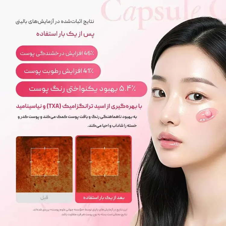 کرم کپسولی ضد لک ترانگزامیک اسید و نیاسینامید 5% مدی کیوب اصل Medicube TXA حجم 55 گرم