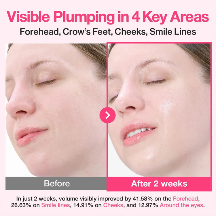سرم ضدحساسیت و حجیم کننده پوست نامبوزین مدل Rose PDRN Collagen 2 حجم 30 میل