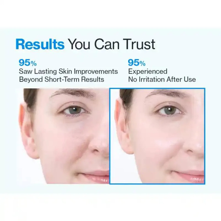 سرم رتینول شماره 3 نامبوزین اصل Numbuzin Blue Bio Retinol | پاکسازی عمیق و کوچک کننده منافذ باز حجم 30 میل