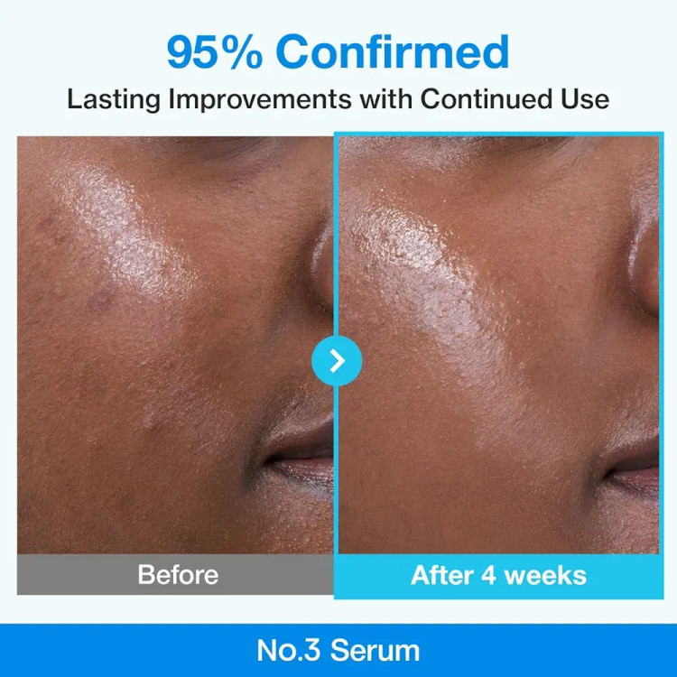 سرم رتینول شماره 3 نامبوزین اصل Numbuzin Blue Bio Retinol | پاکسازی عمیق و کوچک کننده منافذ باز حجم 30 میل