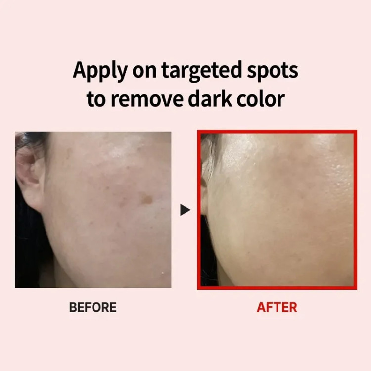 کرم ضد لک و روشن کننده ملانین ایکس مدی پیل اصل MEDI-PEEL Melanon X Cream حجم 30 میل