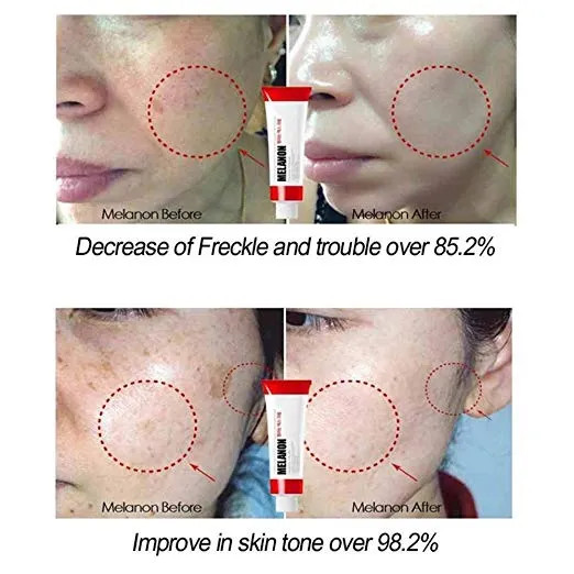 کرم ضد لک و روشن کننده ملانین ایکس مدی پیل اصل MEDI-PEEL Melanon X Cream حجم 30 میل