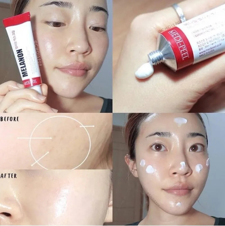 کرم ضد لک و روشن کننده ملانین ایکس مدی پیل اصل MEDI-PEEL Melanon X Cream حجم 30 میل