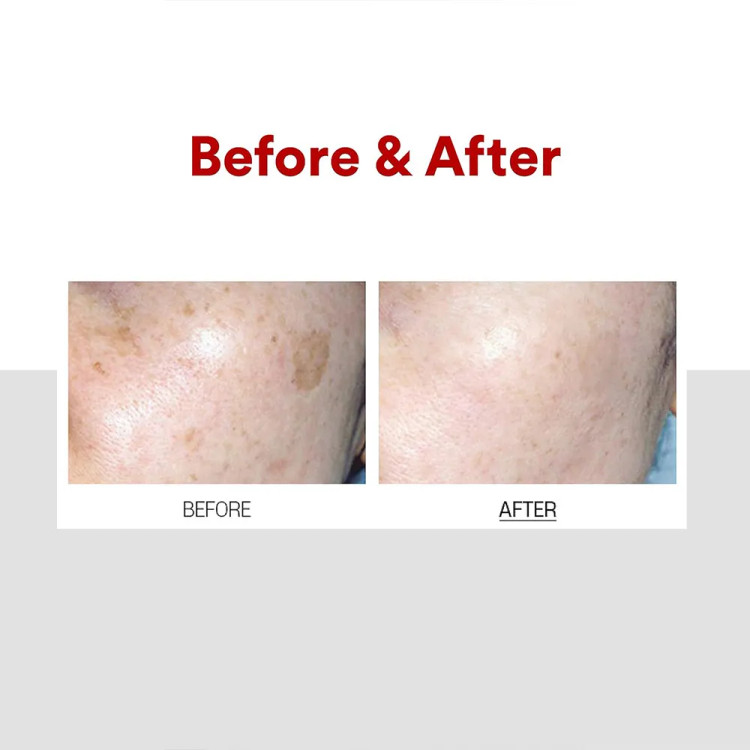 کرم ضد لک و روشن کننده ملانین ایکس مدی پیل اصل MEDI-PEEL Melanon X Cream حجم 30 میل