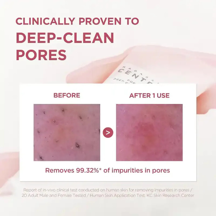 شوینده پوست چرب سنتلا اسکین 1004 اصل Centella پاکسازی عمیق منافذ، لایه بردار ملایم و تسکین دهنده حجم 125 میل