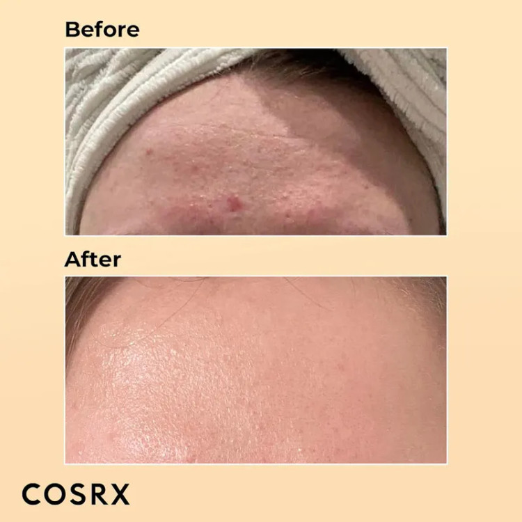 کرم آبرسان و مرطوب کننده حلزون کوزارکس اصل COSRX حجم 100 گرم