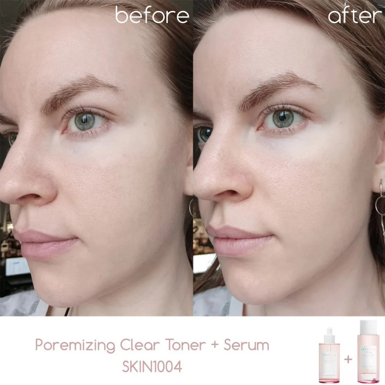 سرم کنترل و کوچک کننده منافذ سنتلا اصل POREMIZING FRESH حجم 100 میل